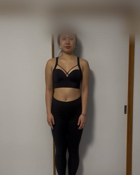 Client progress photo