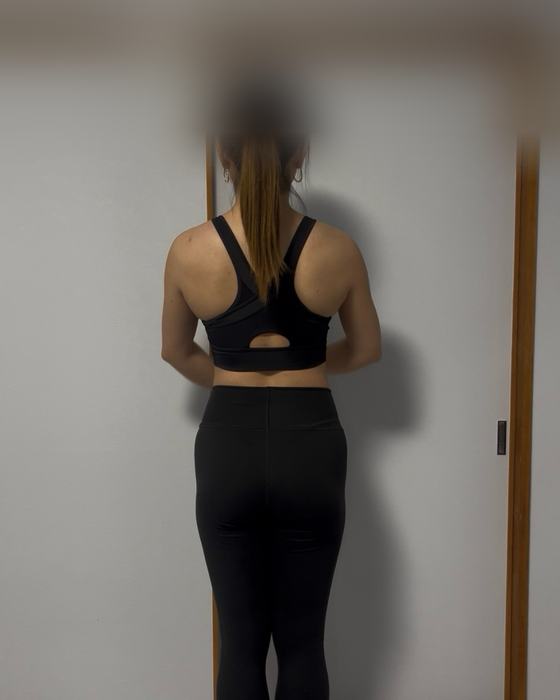 Client progress photo