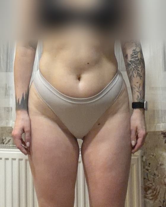 Client progress photo