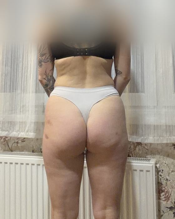 Client progress photo