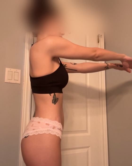 Client progress photo